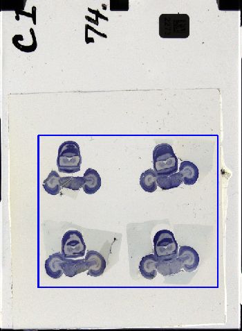 Media type: image; Special Collections 3298   shows specimen_part histological serial section;